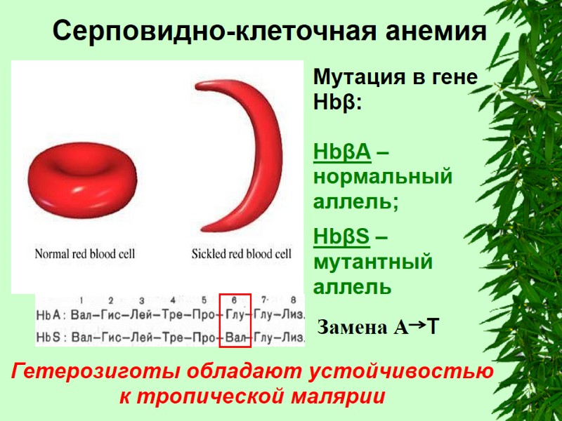 Серповидно-клеточная анемия Гетерозиготы обладают устойчивостью к тропической малярии Мутация в гене Hbβ:  HbβА